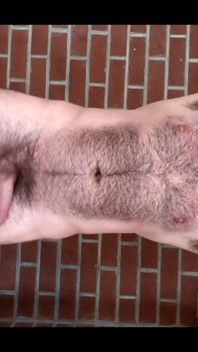 hairy boy 