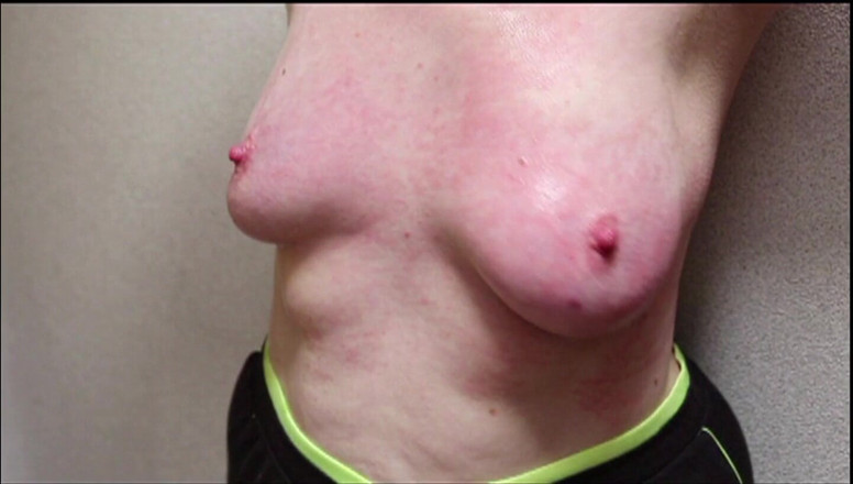 Bouncy Tits Action: スローモーションフルで乳首鞭打ち