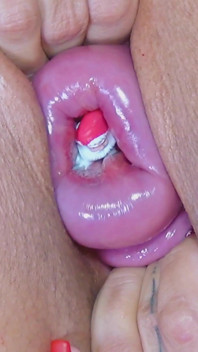 Santa Claus Visits My Uterus