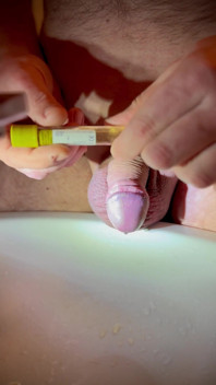 Come fare un test delle urine da un pene!