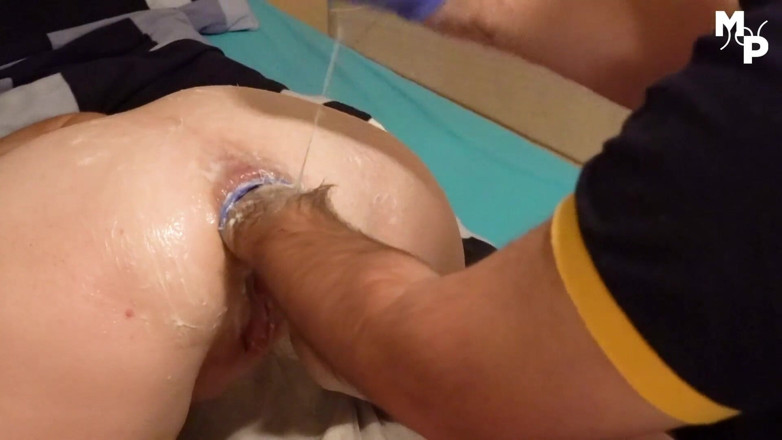 Marcus Pollack: Fisting dan bola boccial