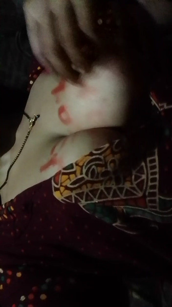 Soni sk: Fetish Solo Ginjal