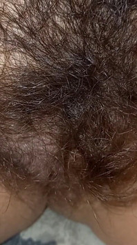 Shorts Hairy