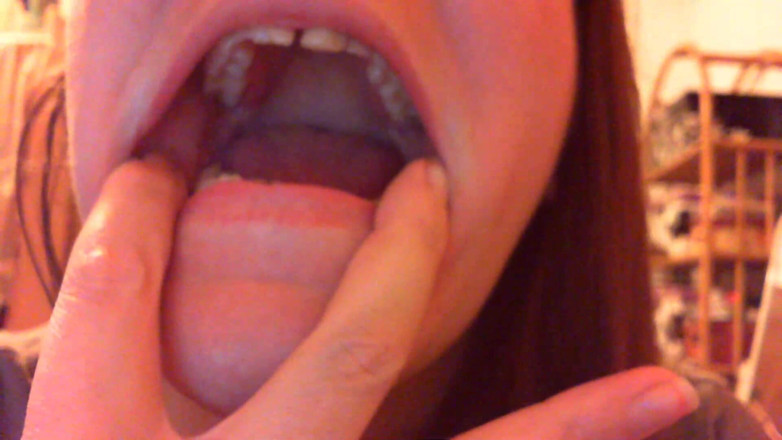 Nicoletta Embassi: Teeth Fetish Devour