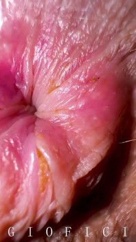 Anal Fetish: I Am Lookin at the Ceiling While My Stepfather Sniffed and Licked My Butthole