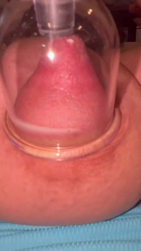 Nipple Cupping Part 2