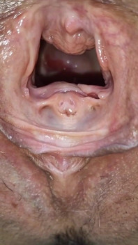 Spreading and Gaping Outdoors in Public Park