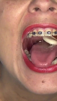 Playing and Swallowing Gummy Eggs