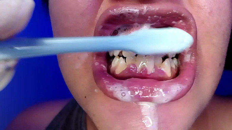 Elimoon: Čištění mých zubů a ukazování mých zubů (detail)