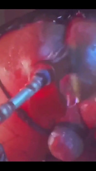 Intense Verbal Play Ahead...