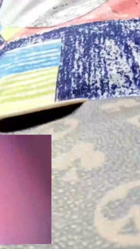 Wallowing a Pill Cam While Walking Inside My Stomach POV