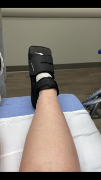 Welp, I messed up my foot