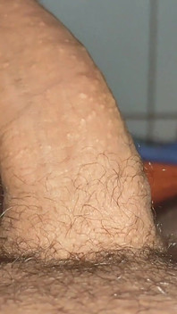 Kontol besar yang belum disunat membuka phimosis kelenjar.
