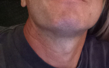 Thomas del Oro: Bored Today