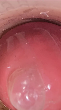 The Camera in the Deep Pussy Records a Huge Ejaculation of Sperm Into the Condom