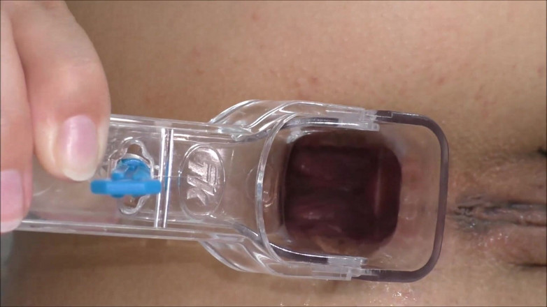 Helena Moeller: Squirted using speculum in the anus