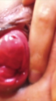 Poprvé Prolapse Její Těsná asijská kundička