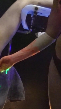 1st. Uv-neon Light Anal Fisting Experience of Adelina Noir and Fistdude