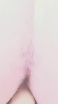 Yapay Penis