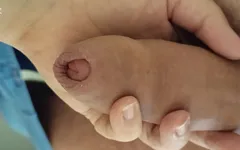 Stik tebal.. Penis yang sangat tebal.