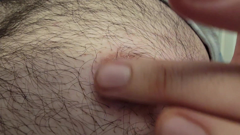 Chunky Belly Boy: पेट, नावेल, निप्पल देखने का बिंदु