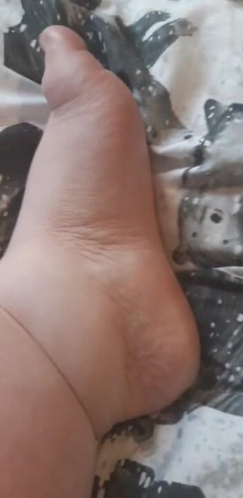 SSBBWLadyBrads: Piedi grassi paffuta