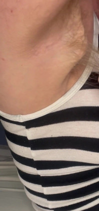 Cspot Showing Armpit Hair