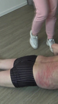 Old Patient Kicked by Home Help