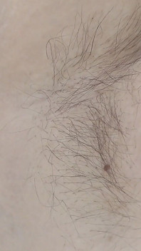Detailní naolejované naolejované podpaží