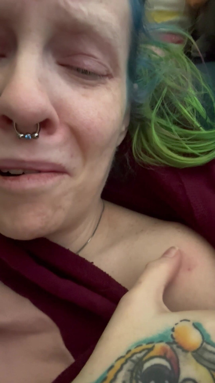 Hot potato girl: Pushing on My Bruise Cuz He’d Like It