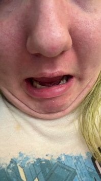 Chin Faces