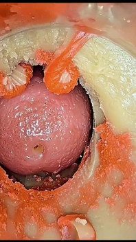 Compilation Di Creampie Parte 5 POV