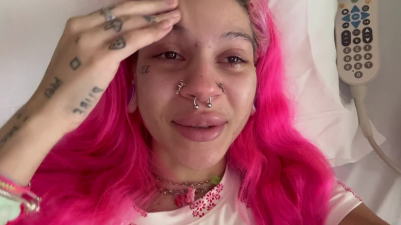 Nali Marie: Scar Fetishes Stitches Staples Hospital Recovery After Surgery Teen Petite...
