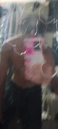 Stroke