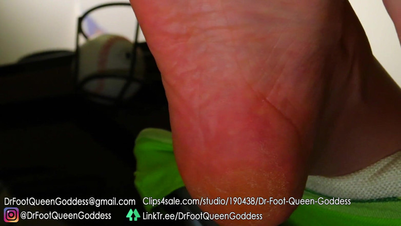 Dr. Foot Queen Goddess: Vratící se přírodní nehty, část 5