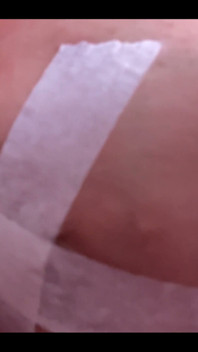My Boob Is About to Explode