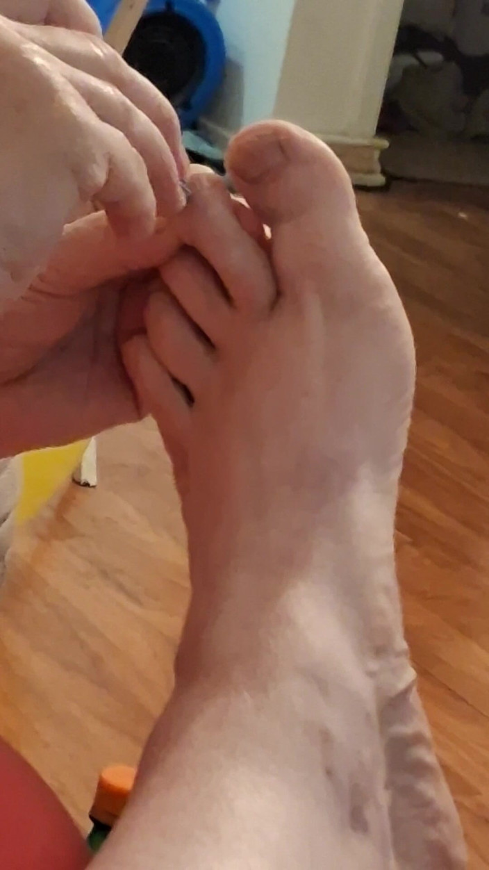 BBW nurse Vicki adventures with friends: 大きなビューティーナース、ヴィッキーが腐った汚れた足でトーの彼氏を切りつける