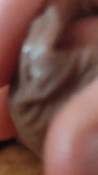 Great Phimosis Getting in the Way of the Boy's Orgasm