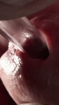Masturbation