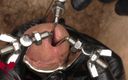 Close Up Extreme: Close up of the Application of a 3-way Urethral Stretcher. the...