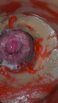 Insemination - Internal Camera Captures Deep Male Ejaculation