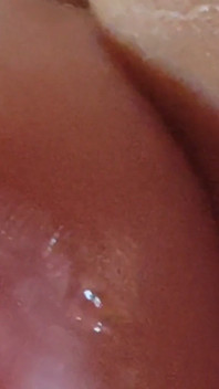 La Dilatation De L’œil Du Gland Réserve Une Agréable Surprise.