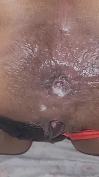 Trying to Get the Sperm Out, It Was so Deep That It Didn't Come Out