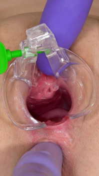 Beautiful Teen Gets Anal Orgasm with a Speculum Inside Her Pussy