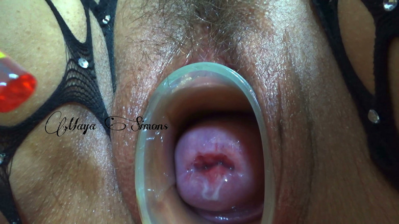 Maya Simons: This Is What My Cervix Looks Like After a Year...