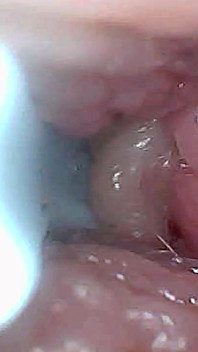 Panduan Visual Untuk Stimulasi G-Spot Dan Orgasme Endoscop Perspektif