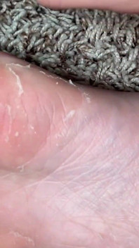 kaki dan pijat kaki ivys feet