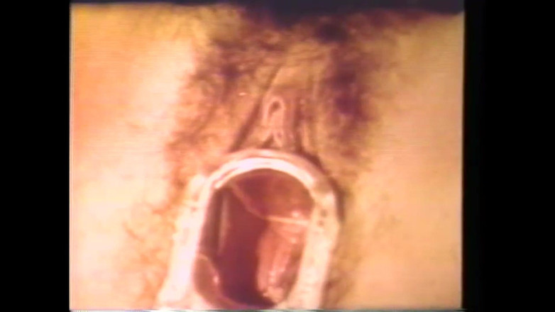 The Unforgettable: Извращенная доктор, часть 2