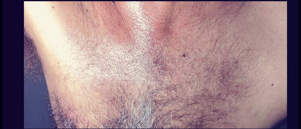 Stink HairyMale: Tělový olej – Hojné vystání