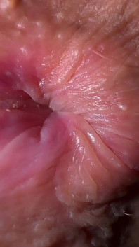 Extreme Close Upzz Stop Quietly Farting